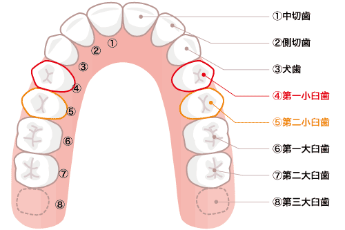 抜歯になる第一小臼歯と第二小臼歯
