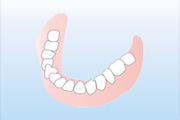 下顎義歯