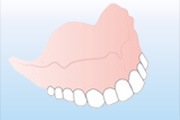 上顎義歯